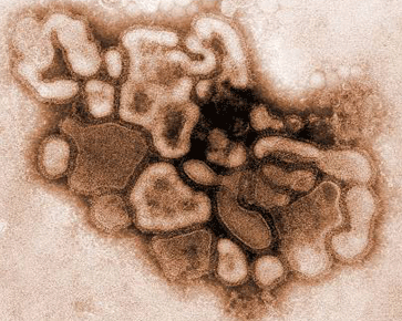 Vírus H1N1